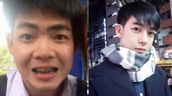 9x lột xác hoàn hảo từ chàng trai đen nhẻm thành 
