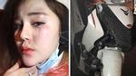 Gái xinh sống ảo: Bị tai nạn vẫn selfie đăng facebook