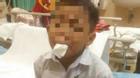Cậu bé 7 tuổi tự cắt lưỡi vì bị bạn bè bắt nạt