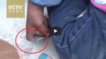 Clip: Giải cứu bé gái 3 tuổi bị mắc ngón tay vào lỗ đài phun nước