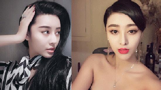 Bạn trai mở hẳn thẩm mỹ viện cho người yêu dao kéo giống Phạm Băng Băng