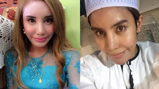 Sau 5 năm chuyển giới thành nữ, triệu phú Malaysia phẫu thuật để trở lại làm nam giới