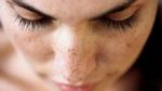 Nhận biết nguy cơ nhiễm độc kim loại qua những biểu hiện trên da