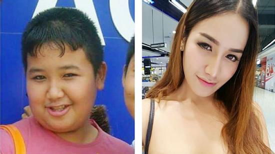 Trường hợp chuyển giới xuất sắc này thật kinh ngạc