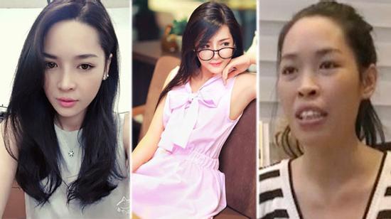 Thanh Quỳnh - cuộc đời có sang trang sau khi phẫu thuật thẩm mỹ?