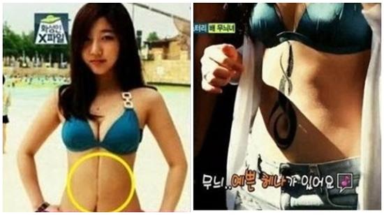 Sự thật về vết sẹo dài trên bụng mỹ nữ khiến triệu người cảm phục