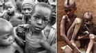 Những đứa trẻ châu Phi gầy trơ xương vì đói sẽ khiến bạn không dám bỏ thừa đồ ăn
