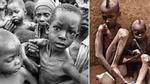 Những đứa trẻ châu Phi gầy trơ xương vì đói sẽ khiến bạn không dám bỏ thừa đồ ăn