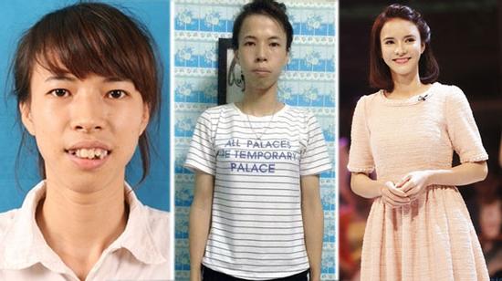Xấu cũng là cái tội: Cô gái này từng muốn kết thúc cuộc đời bằng cái chết