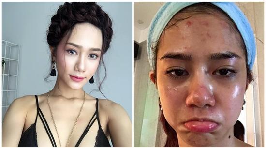 9X xinh đẹp chia sẻ trải nghiệm 'tiền mất tật mang' vì lăn kim