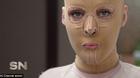 Bất ngờ với khuôn mặt cô gái tháo bỏ mặt nạ sau hơn 2 năm giấu mình vì bị đánh ghen
