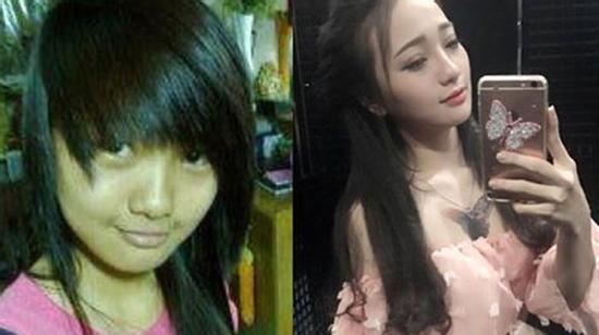 Khoe ảnh “lột xác”, cô nàng bị “ném đá” vì cho rằng “bán vốn tự có” để lấy tiền phẫu thuật nói gì?