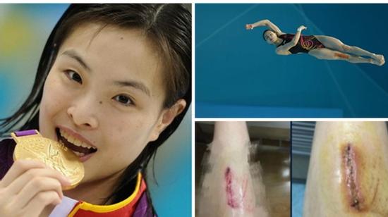 Góc khuất day dứt phía sau kỷ lục Olympic của 