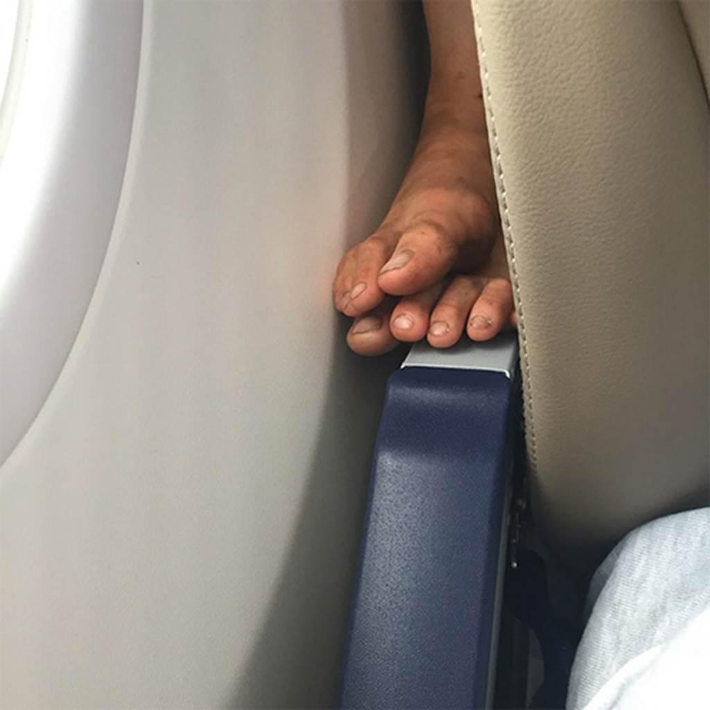 Отекают ноги в самолете