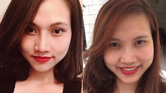 Bị nhà chồng chê xấu, mẹ một con đi phẫu thuật thẩm mỹ “lột xác” thành hot girl