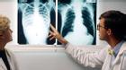 Dấu hiệu nhận biết sớm bệnh ung thư phổi