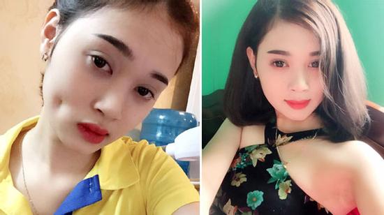 Ham má lúm đồng tiền khuôn mặt cô gái trẻ bị biến dạng thảm hại