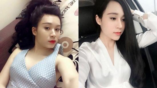 Cô gái trẻ nghiện phẫu thuật thẩm mỹ chia sẻ những biến chứng và tác hại mà mình phải chịu đựng