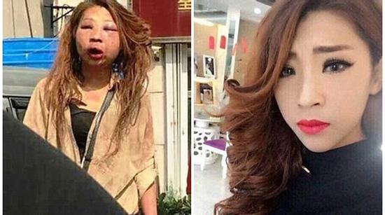 Sau khi bị đánh ghen, đến bố mẹ cũng chẳng nhận ra đây là con gái mình