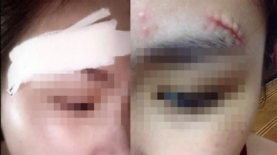 Chàng trai đối xử tàn tệ, đá rách mặt bạn gái cũ