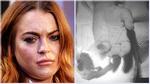 Lindsay Lohan gặp tai nạn cắt mất nửa ngón áp út trái
