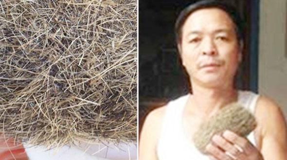 Nghệ An: Thịt lợn nái, phát hiện vật nghi là 'cát lợn' quý hiếm trị giá trăm tỉ đồng-2