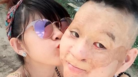 Cuộc sống khó tin của kiều nữ và anh chàng mặt biến dạng ở TP.HCM