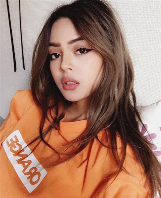 Vì sao con gái Việt lại phát cuồng với xu hướng môi dày đến như vậy? - Ảnh 2.