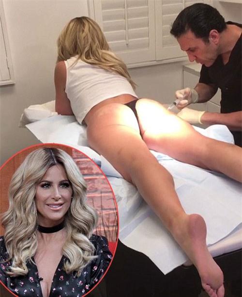 sao-truyen-hinh-my-tiet-lo-hinh-anh-di-bom-mong