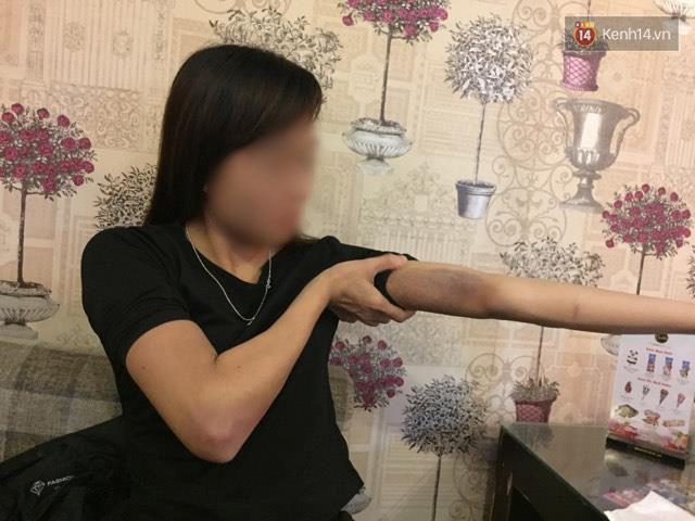 Nỗi kinh hoàng của cô gái sau khi bị bạn trai đánh dã man, thâm tím hết cả người - Ảnh 1.