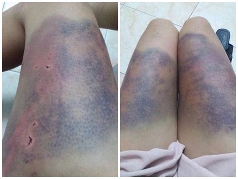 Đêm kinh hoàng của cô gái ở Hà Nội: 