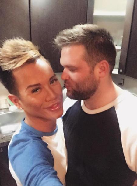 chang-trai-thuong-xuyen-tiem-botox-de-giong-bup-be-ken-2