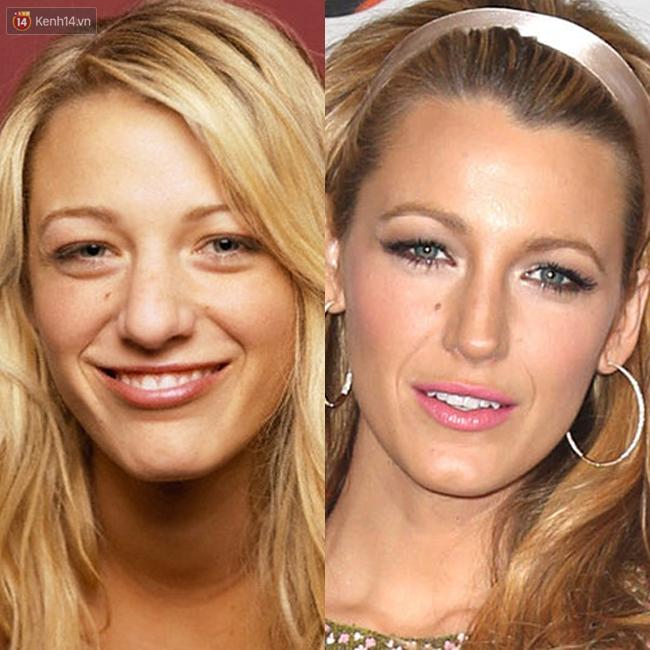 Nhìn sao trước và sau khi nổi tiếng, bạn sẽ nhận ra: Mình không xấu, chỉ là chưa giàu thôi!-11