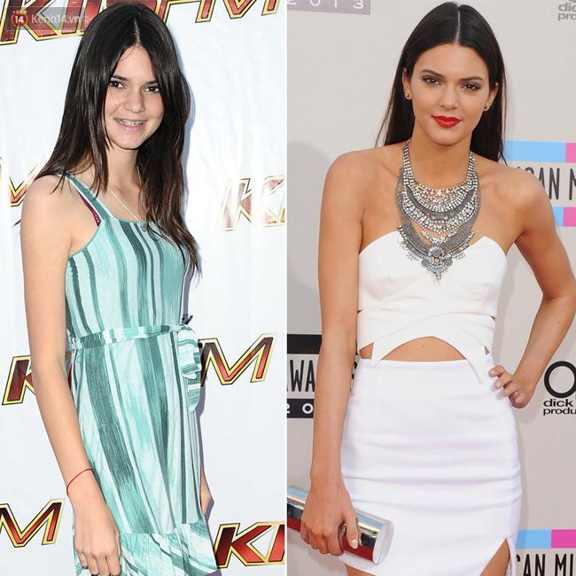 Nhìn sao trước và sau khi nổi tiếng, bạn sẽ nhận ra: Mình không xấu, chỉ là chưa giàu thôi!-9