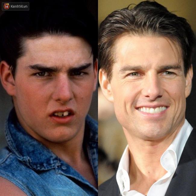 Nhìn sao trước và sau khi nổi tiếng, bạn sẽ nhận ra: Mình không xấu, chỉ là chưa giàu thôi!-14