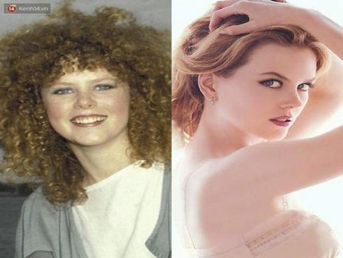 Nhìn sao trước và sau khi nổi tiếng, bạn sẽ nhận ra: Mình không xấu, chỉ là chưa giàu thôi!