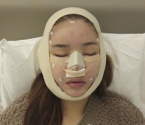 Những sao Việt phẫu thuật thẩm mỹ trong năm 2016: Người thành công - Kẻ thành thảm họa-6