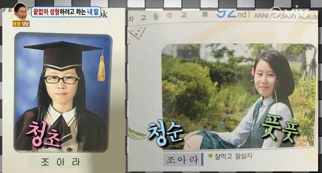 Nữ sinh Hàn Quốc phẫu thuật thẩm mỹ để có nét đẹp đậm chất tây như Kylie Jenner - Ảnh 5.