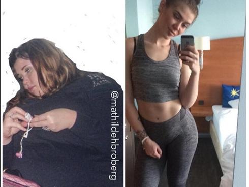 Nữ sinh Đan Mạch béo phì gây choáng khi giảm gần 60kg