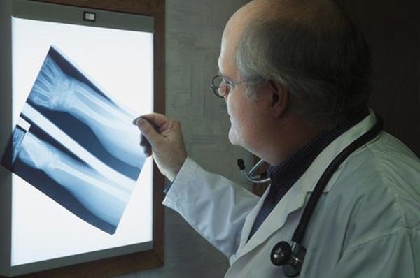 5 chấn thương hay gặp trong khi tập thể dục, thể thao và cách phòng tránh - Ảnh 6.