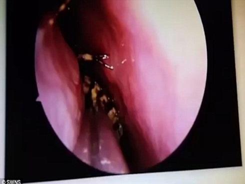 Gián lạc đường, chui vào hộp sọ người để làm tổ