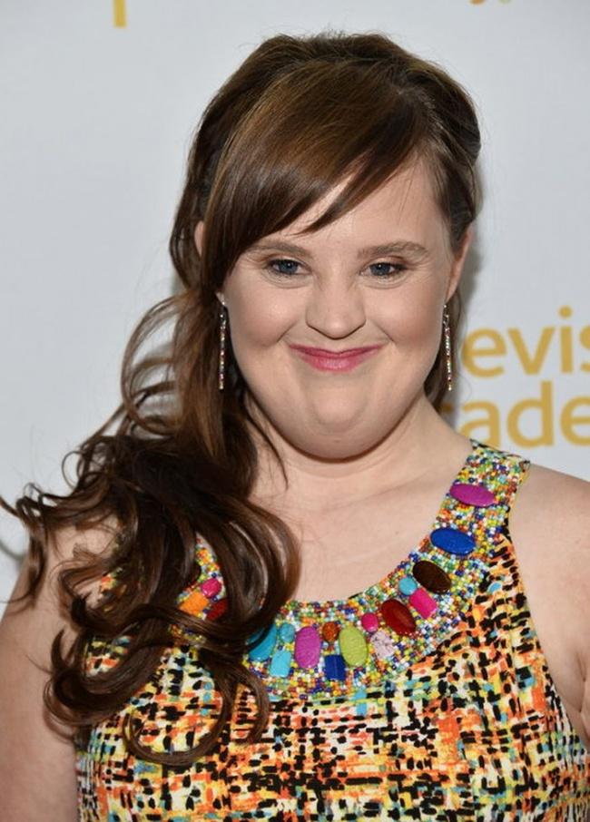 4. Jamie Brewer
Jamie Brewer được nhiều người biết đến như là người mẫu đầu tiên mắc hội chứng Down trên thế giới. Hiện, Jamie đang là một diễn viên, người mẫu khá nổi tiếng.