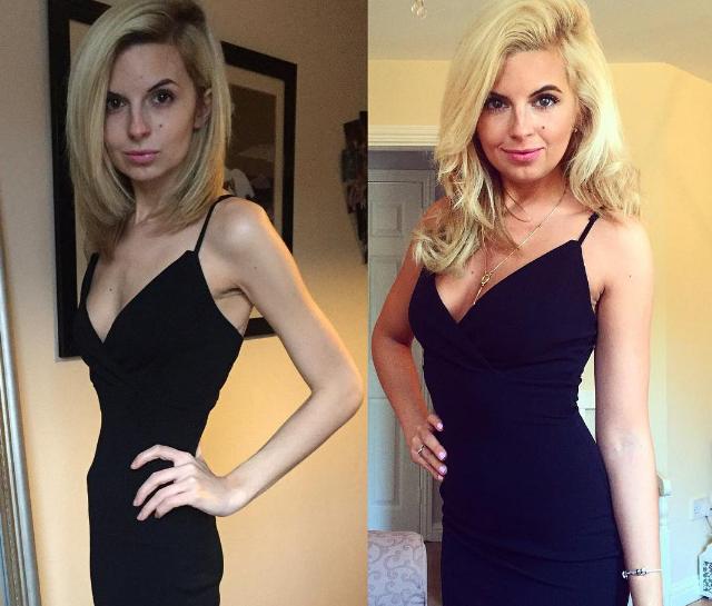 Nhung co gai tro nen xinh dep sau khi tu bo viec an kieng hinh anh 1