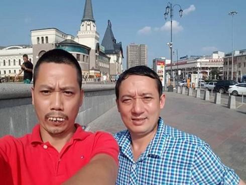 Choáng với tạo hình răng vẩu, ngọng 