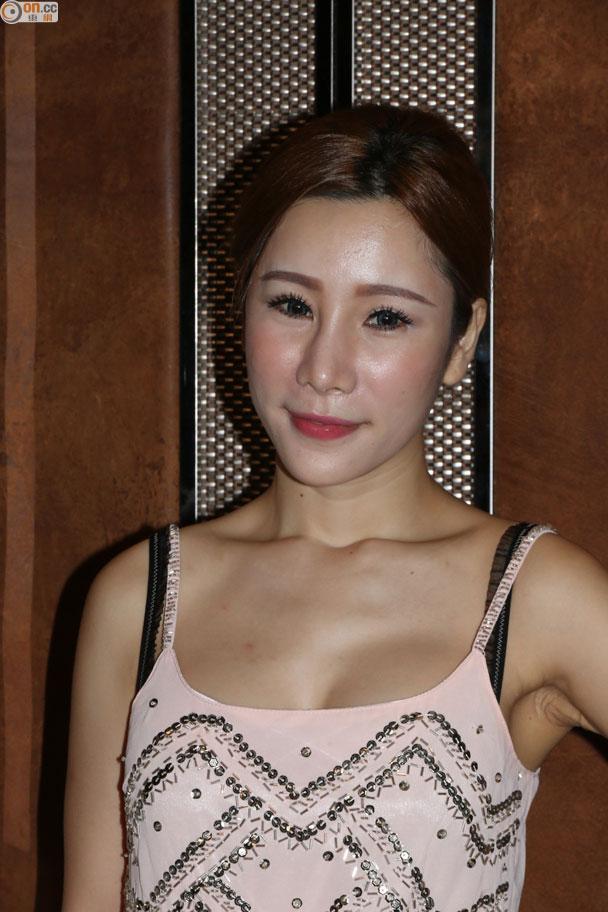 Đòi xinh đẹp như Angela Baby, mẫu nữ Hồng Kông trả giá đắt với chiếc mũi phẫu thuật thẩm mỹ... lệch - Ảnh 6.