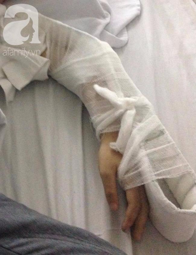 Xe điện tự cân bằng - đừng coi thường mà rước họa vào thân - Ảnh 2.