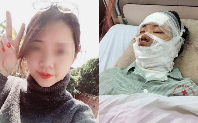 Cô gái xinh đẹp bị bỏng toàn bộ gương mặt khi 55 quả bóng bay trên tay bất ngờ phát nổ - Ảnh 2.