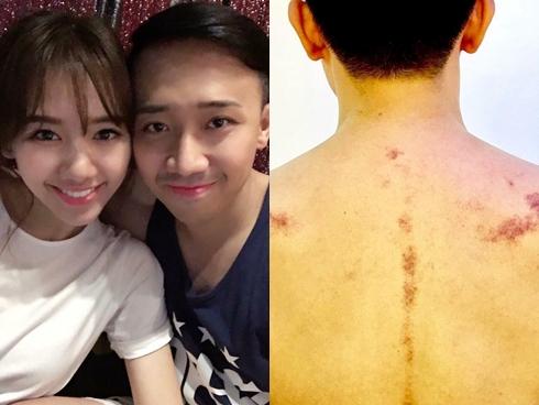 FB 24h: Cạo gió khiến Trấn Thành 'khóc không thành tiếng', Hari Won nói gì?