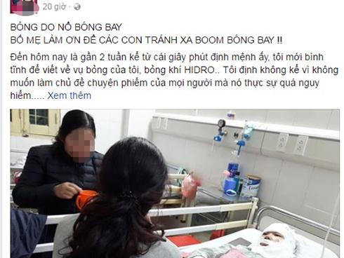 Cô gái trẻ bàng hoàng kể thời điểm nổ bóng bay bị bỏng cả khuôn mặt