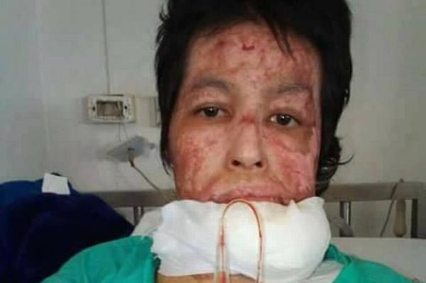 nguoi-phu-nu-thai-lan-bi-chong-tm-xang-thieu-song-vi-ghen